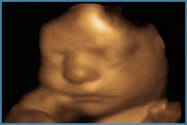 Surrogacy Step 4: Surrogate Pregnancy 